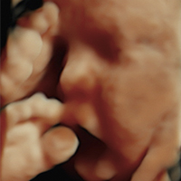 Ultrasonido - Medicina Fetal Campeche