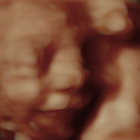 Ultrasonido - Medicina Fetal Campeche