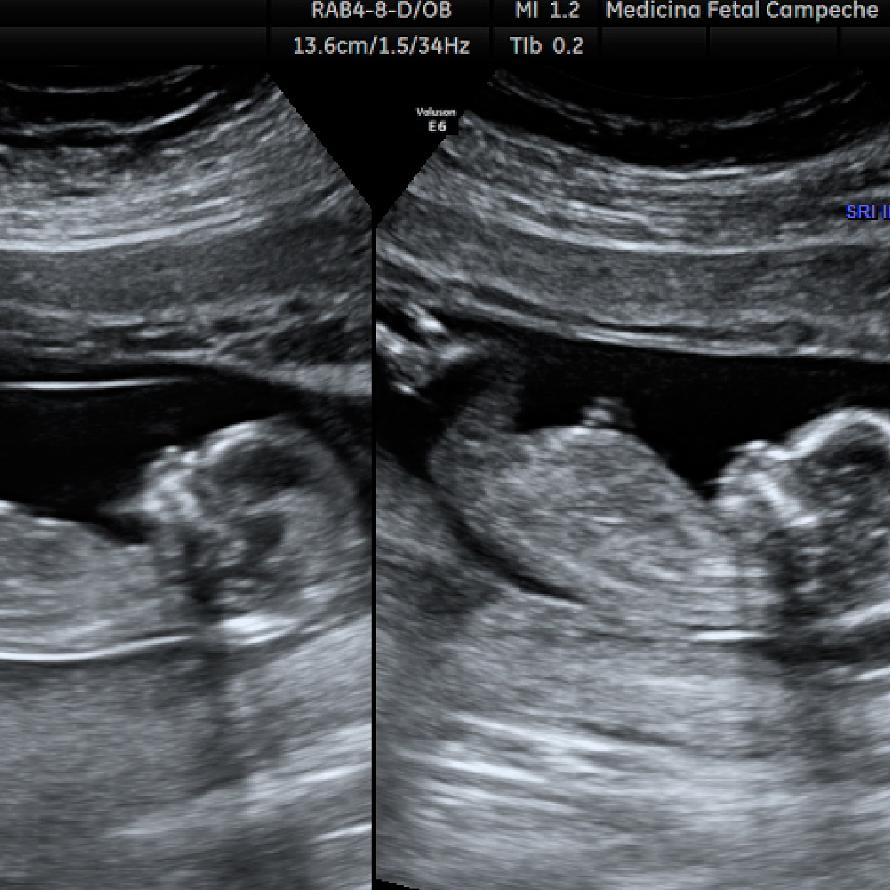 Perfil Biofísico Múltiple