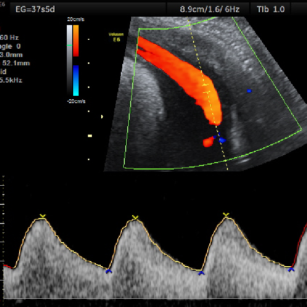 Tamizaje 1er Trimestre
