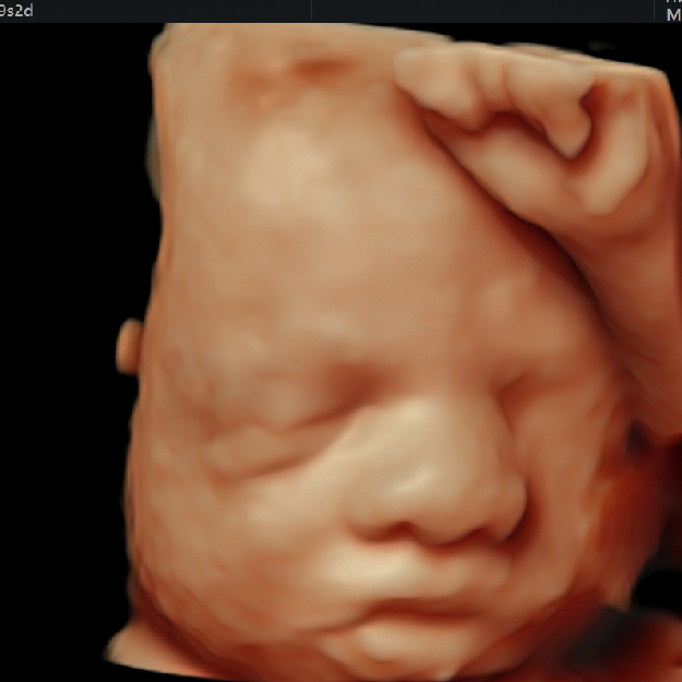 Estructural 3er. Trimestre