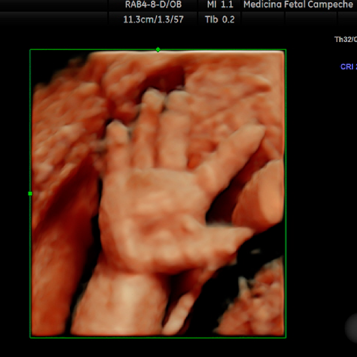 Tamizaje 2do. Trimestre Múltiple