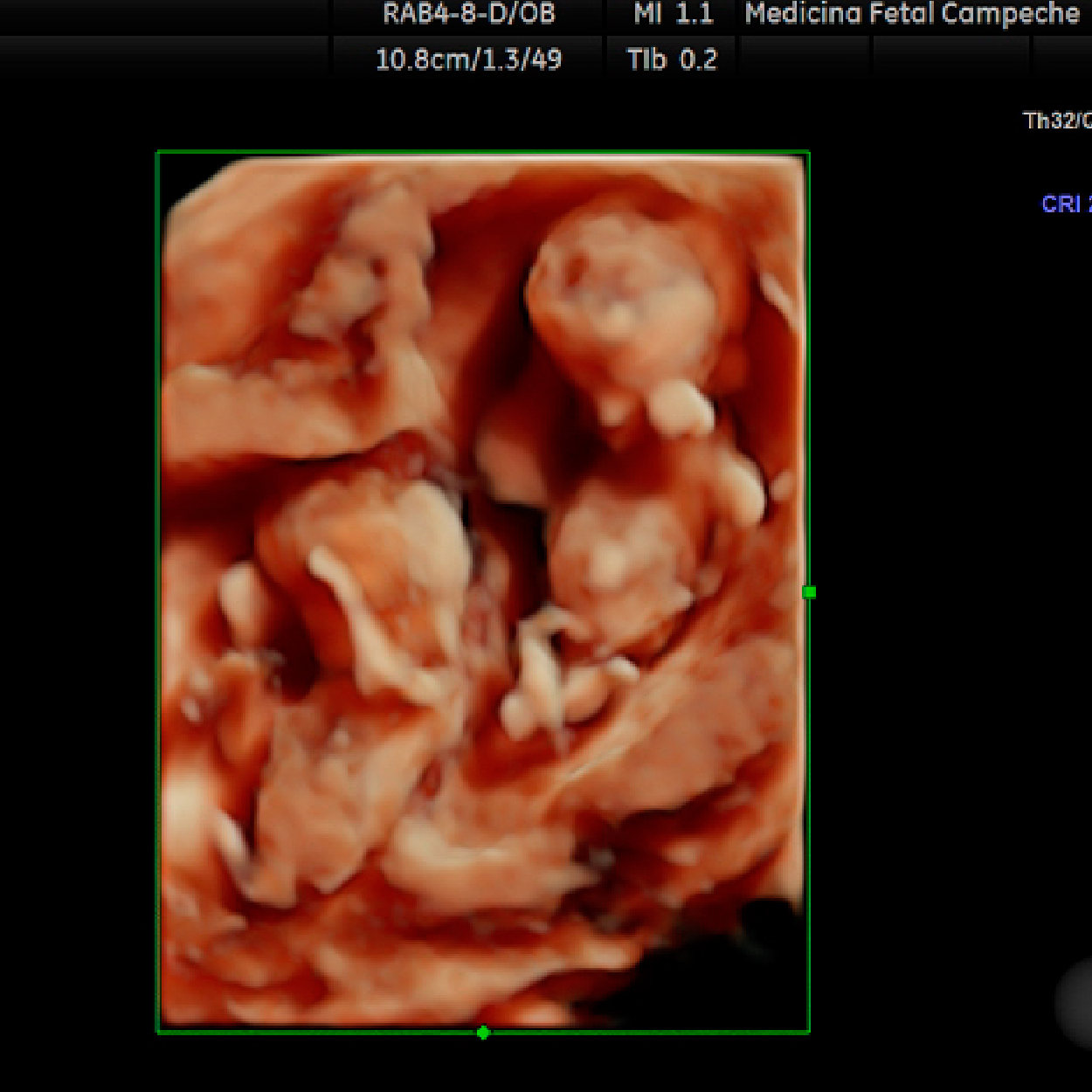 Seguimiento Obstétrico