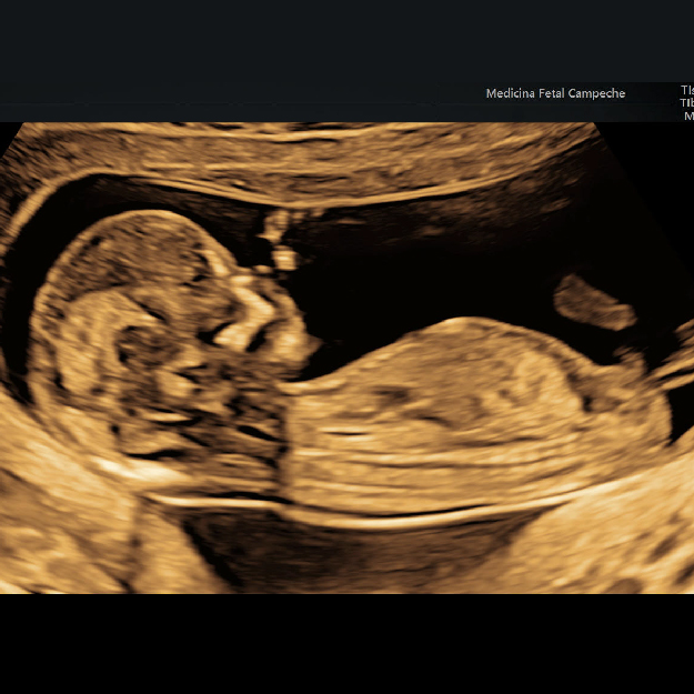 Tamizaje 1er Trimestre