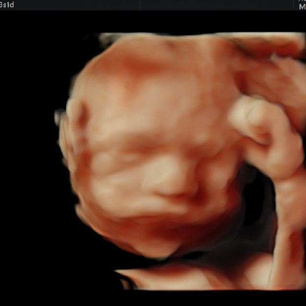 Tamizaje 2do. Trimestre